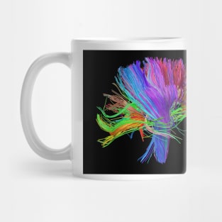 White matter fibres of the human brain (C023/9414) Mug